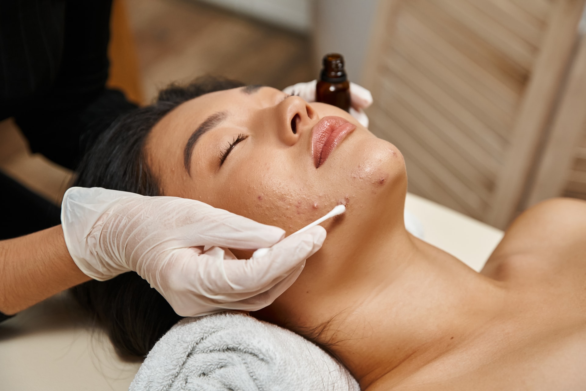 Acne Treatment process illustration